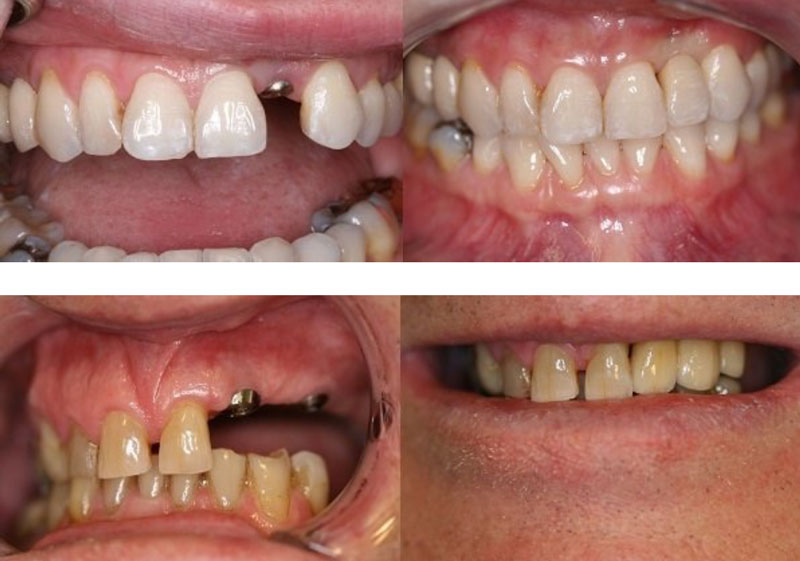 dentists in auckland dentists in auckland