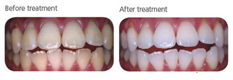 dental hygiene dental hygiene